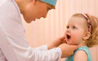 Стоматит у ребенка: причины, симптомы и лечение в домашних условиях